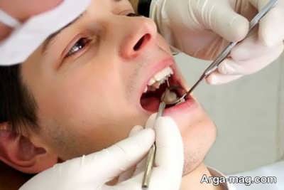 روش های پیشگیری از سرطان دهان
