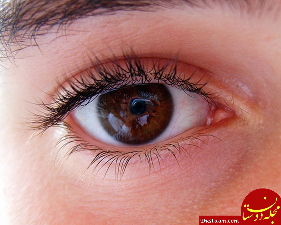 www.dustaan.com - چه چیزهایی باعث کاهش بینایی چشم هایتان می شود؟