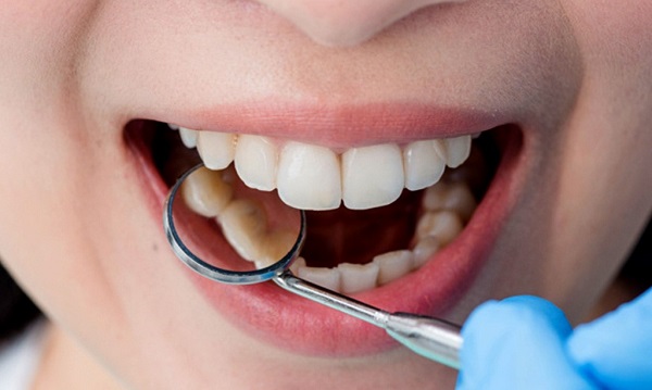 بهترین خدمات دندانپزشکی برای اصلاح طرح لبخند چیست ؟, جدید 99 -گهر