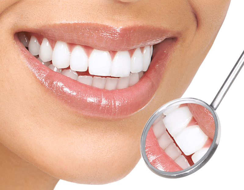 از علت تا درمان لکه های سفید روی دندان