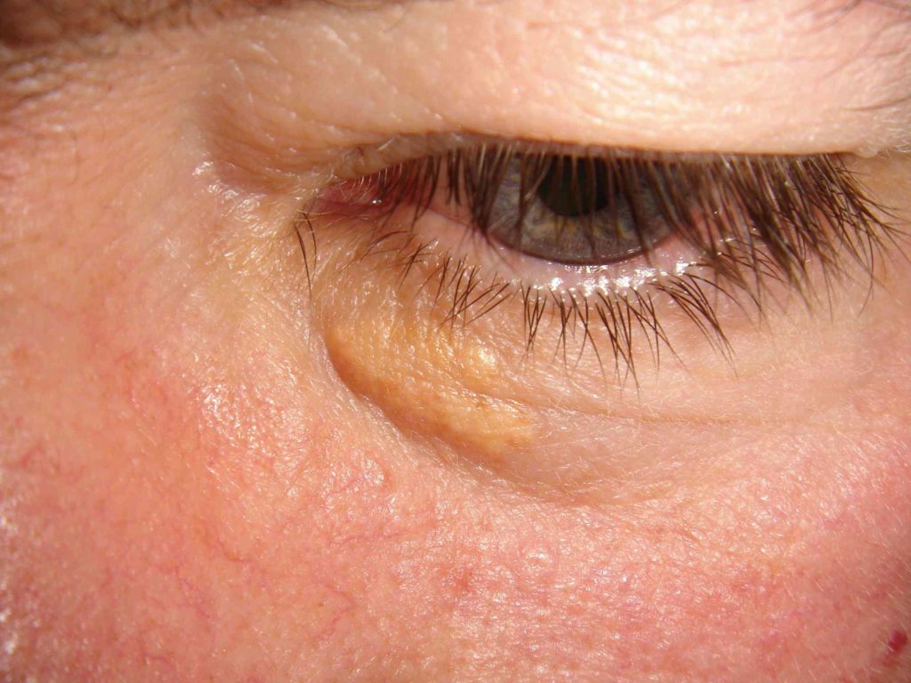 علائم مشکلات سلامتی در چشم ها چیست؟