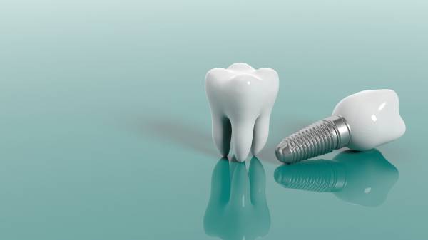 مراقبت بعد از ایمپلنت دندان: رژیم مناسب و بهداشت دهان
