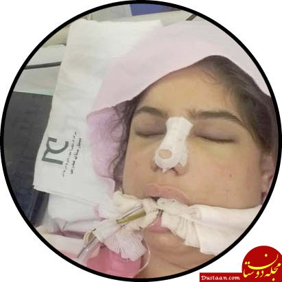 www.dustaan.com مرگ آرزوی دختر تهرانی در جراحی زیبایی +عکس