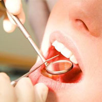 ۷۰ درصد مردم توان مالی برای رفتن به دندانپزشکی را ندارند