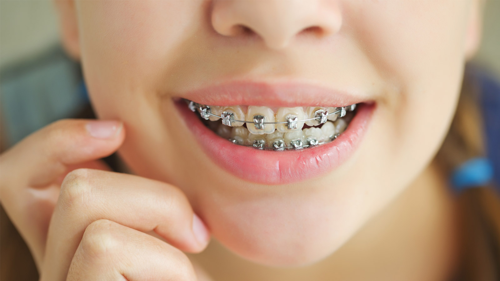 ارتودنسی با دندانهایتان چکار می کند؟