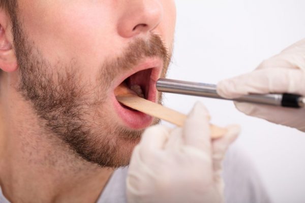 بیماری لیکن پلان دهانی چیست؟ + علائم، علل، تشخیص و درمان