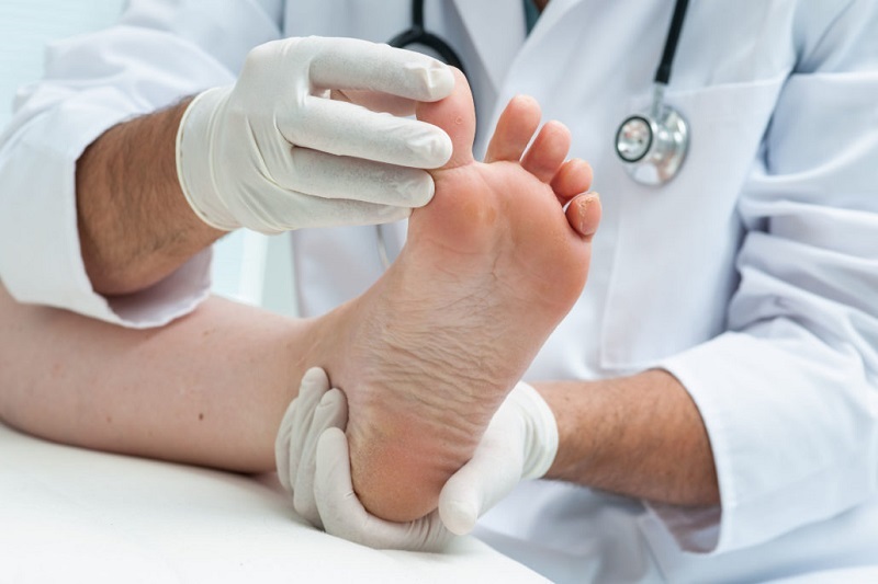 درمان لک های قهوه ای روی پا با 2 پیشنهاد ساده