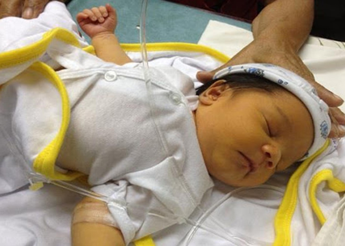 علت زردی نوزادان در بدو تولد و عوامل خطرساز و تشدید کننده