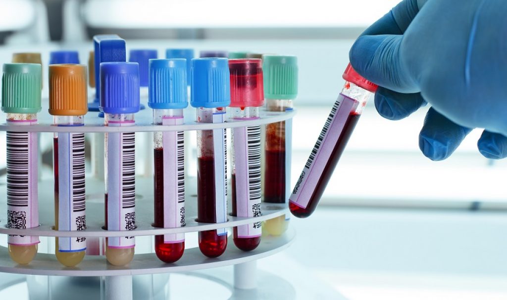 شش موردی که دکتر درباره آزمایش خون به شما نمی گوید