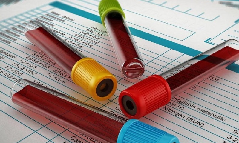 مهمترین فاکتورهایی که در آزمایش خون باید مورد بررسی قرار دهید؟