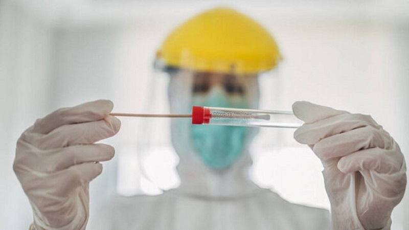 فهرست جدید آزمایشگاه‌های تشخیص کرونا اعلام شد