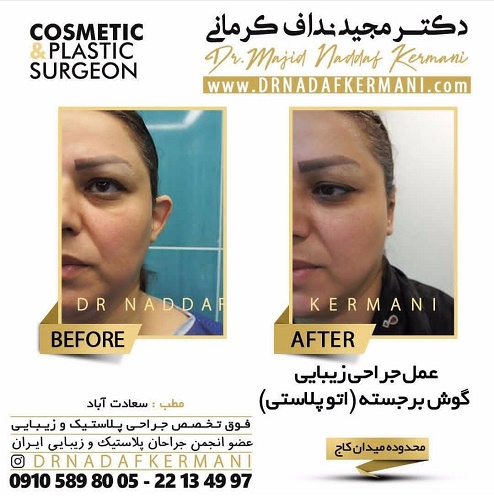 فوق تخصص جراحی پلاستیک و زیبایی در تهران - دکتر نداف کرمانی