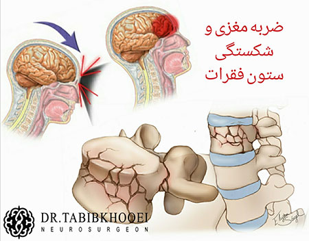 جراحی مغز و اعصاب,جراح مغز و اعصاب در ایران