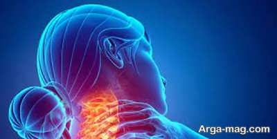 ایجاد احساس درد در گردن به دلیل رادیکولوپاتی