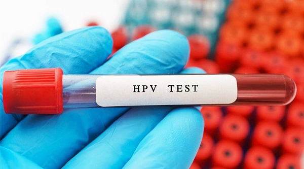 توصیه هایی درباره "ویروس HPV" + عکس نوشت و اینفوگرافیک